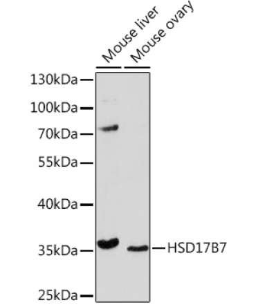 HSD17B7 Rabbit Polyclonal Antibody