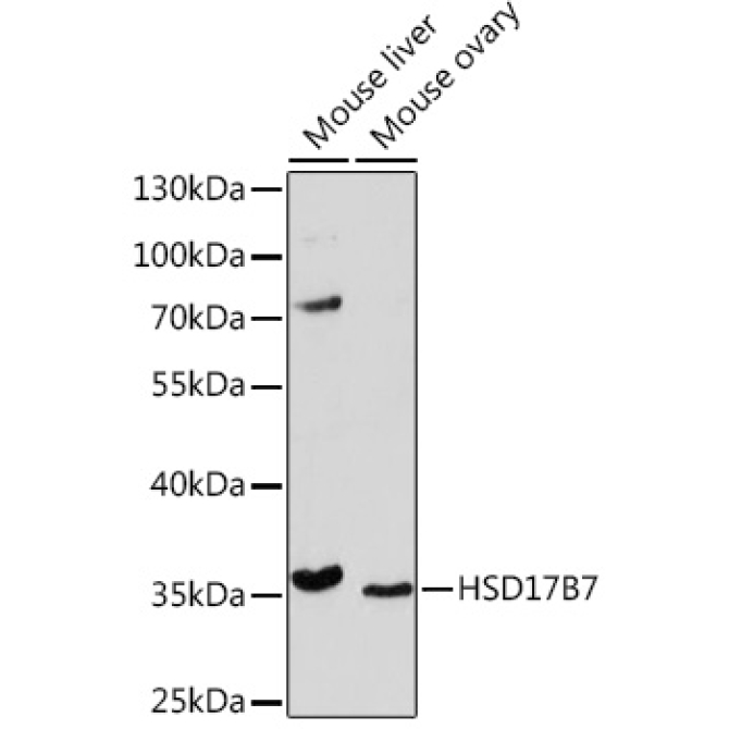 HSD17B7 Rabbit Polyclonal Antibody