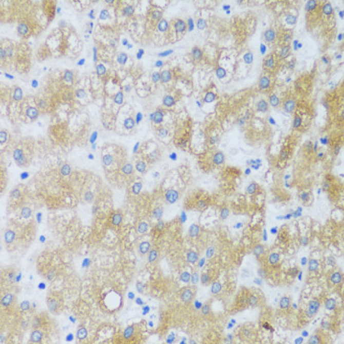 ASB4 Rabbit Polyclonal Antibody