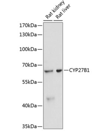 CYP27B1 Rabbit Polyclonal Antibody