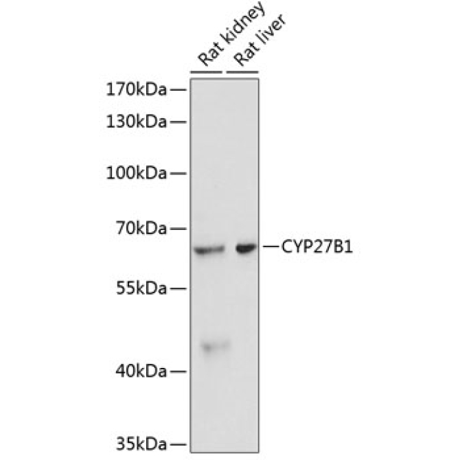 CYP27B1 Rabbit Polyclonal Antibody