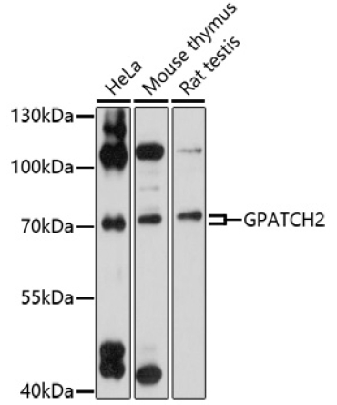 GPATCH2 Rabbit Polyclonal Antibody