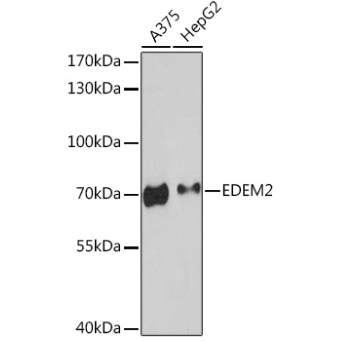 EDEM2 Rabbit Polyclonal Antibody