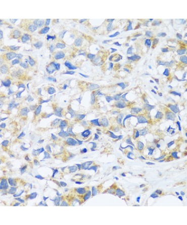 BRK1 Rabbit Polyclonal Antibody