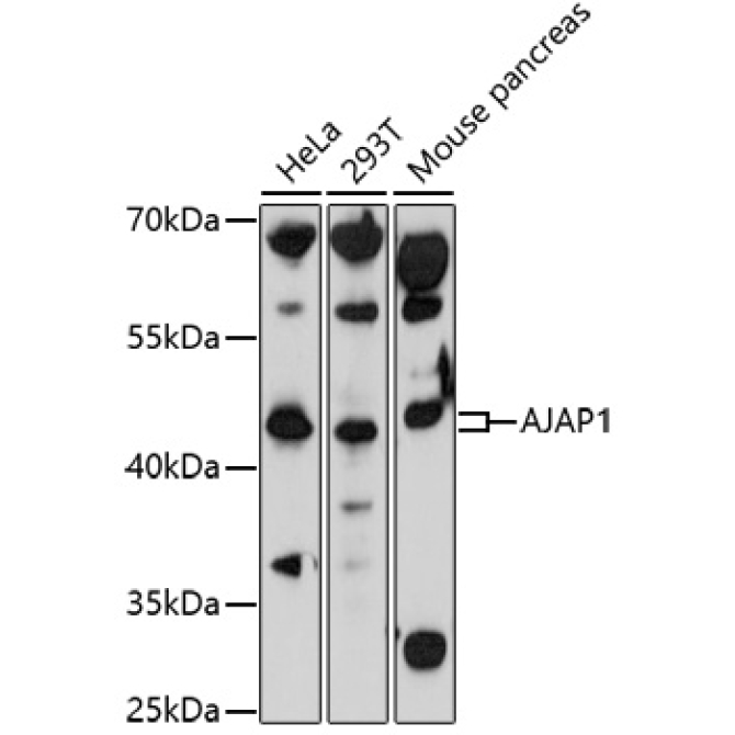 AJAP1 Rabbit Polyclonal Antibody