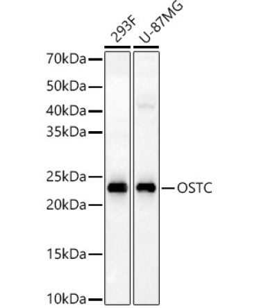 OSTC Rabbit Polyclonal Antibody