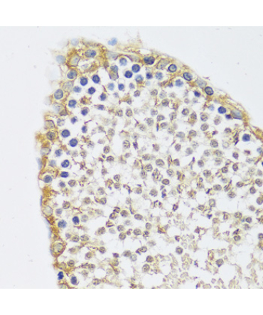 C12orf10 Rabbit Polyclonal Antibody