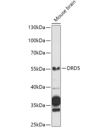 DRD5 Rabbit Polyclonal Antibody