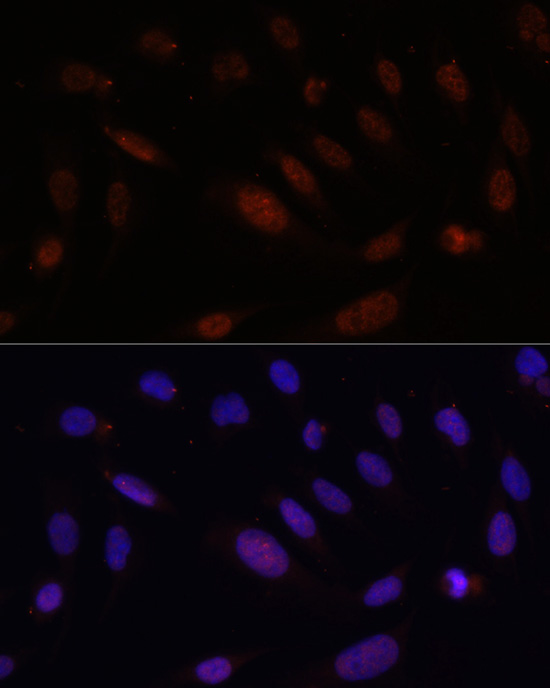 Bcl9 Rabbit Polyclonal Antibody