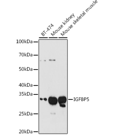 IGFBP5 Rabbit Polyclonal Antibody