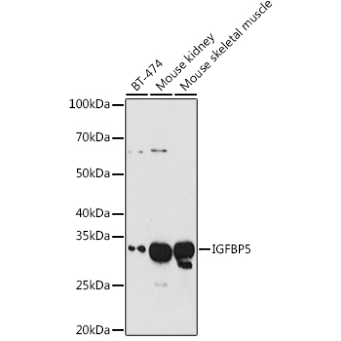 IGFBP5 Rabbit Polyclonal Antibody