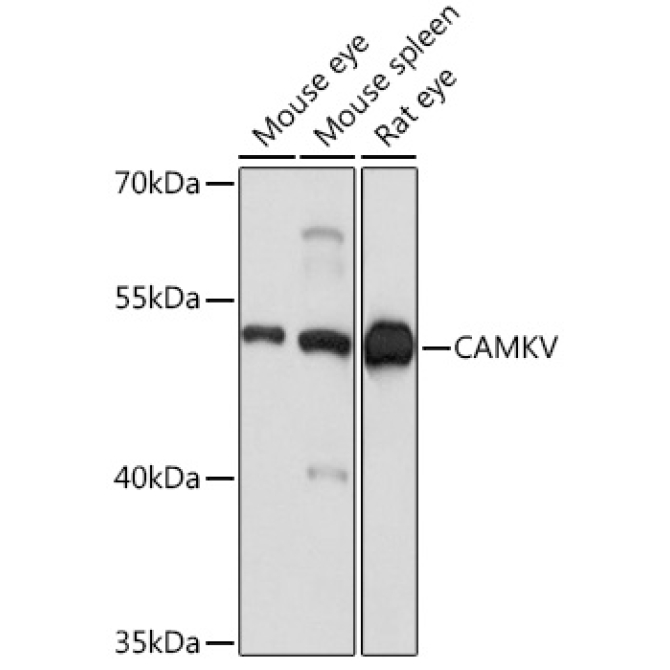 CAMKV Rabbit Polyclonal Antibody