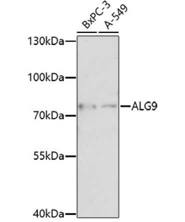ALG9 Rabbit Polyclonal Antibody