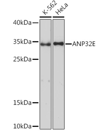 ANP32E Rabbit Polyclonal Antibody