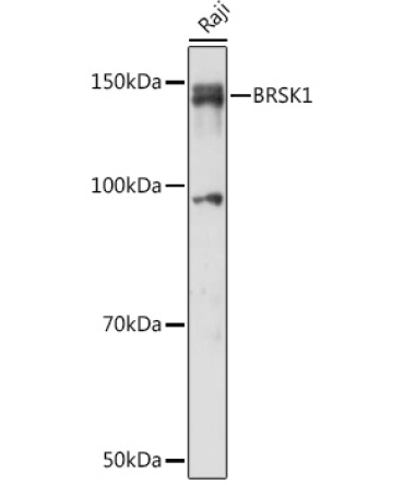 BRSK1 Rabbit Polyclonal Antibody