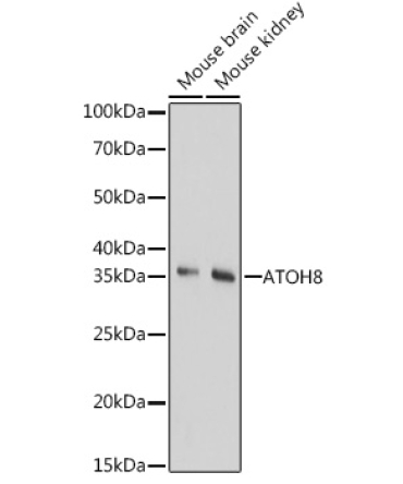 ATOH8 Rabbit Polyclonal Antibody