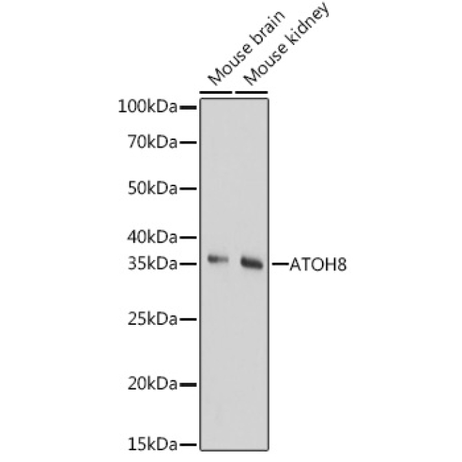 ATOH8 Rabbit Polyclonal Antibody