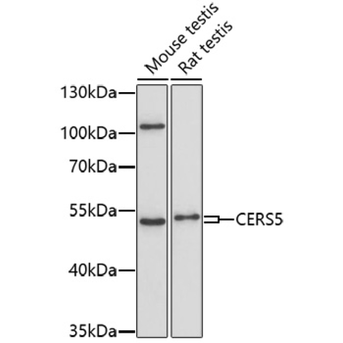 CERS5 Rabbit Polyclonal Antibody