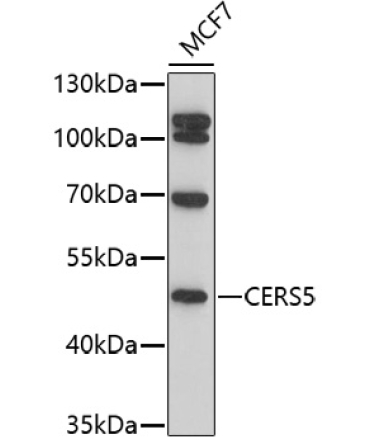 CERS5 Rabbit Polyclonal Antibody