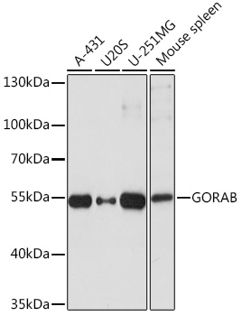 GORAB Rabbit Polyclonal Antibody