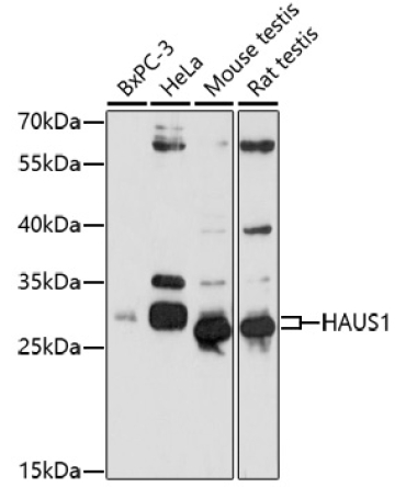 HAUS1 Rabbit Polyclonal Antibody