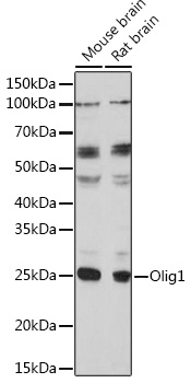 Olig1 Rabbit Polyclonal Antibody