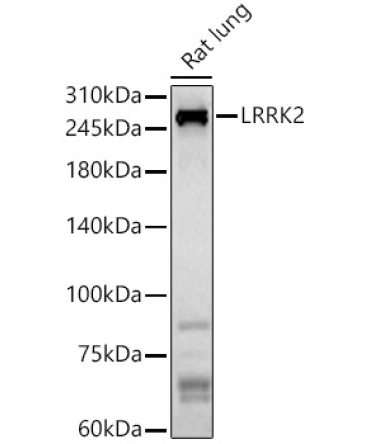 LRRK2 Rabbit Polyclonal Antibody