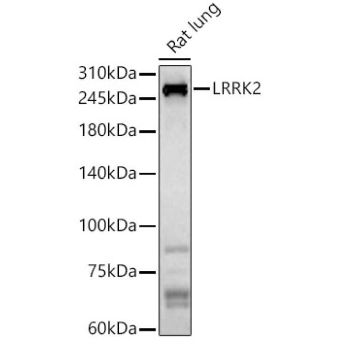 LRRK2 Rabbit Polyclonal Antibody