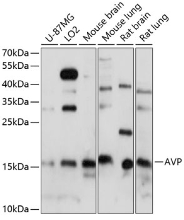 AVP Rabbit Polyclonal Antibody