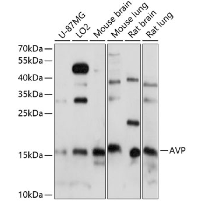AVP Rabbit Polyclonal Antibody