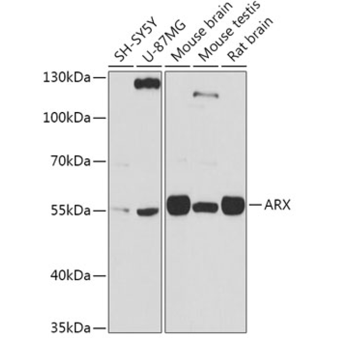 ARX Rabbit Polyclonal Antibody