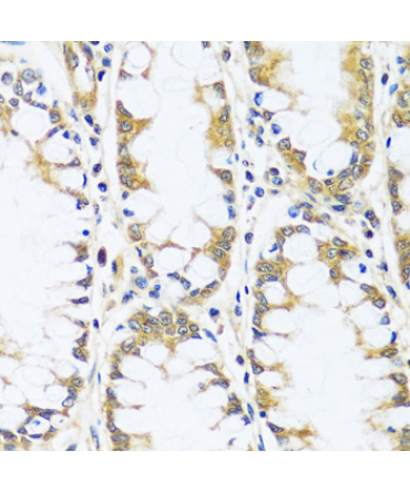 BLOC1S3 Rabbit Polyclonal Antibody