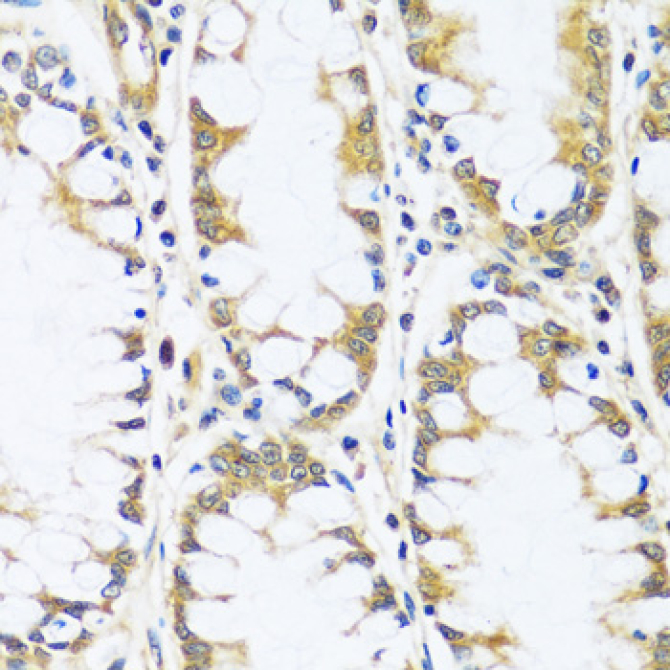 BLOC1S3 Rabbit Polyclonal Antibody