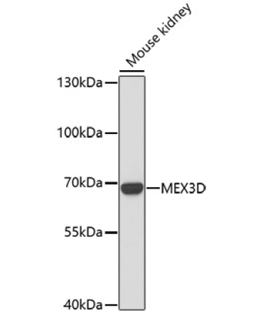 MEX3D Rabbit Polyclonal Antibody