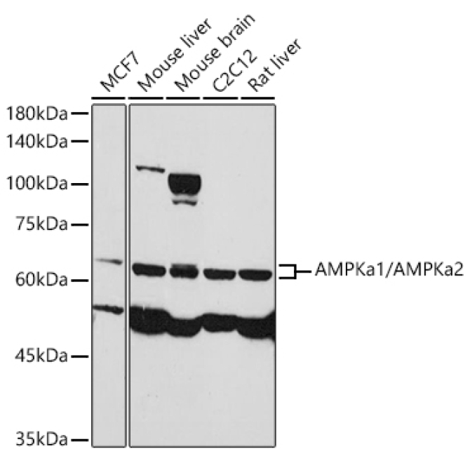 AMPKa1/AMPKa2 Rabbit Polyclonal Antibody