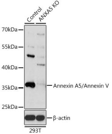 Annexin A5/Annexin V Rabbit Polyclonal Antibody [KO Validated]