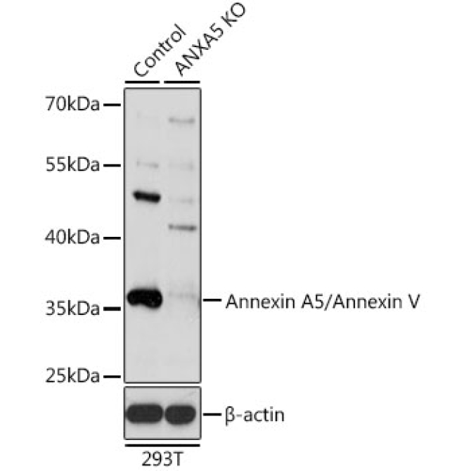 Annexin A5/Annexin V Rabbit Polyclonal Antibody [KO Validated]