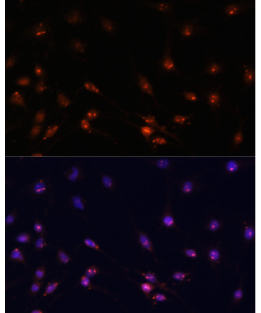 ATR Rabbit Polyclonal Antibody