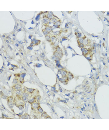 BMPR1B Rabbit Polyclonal Antibody