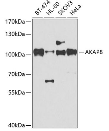 AKAP8 Rabbit Polyclonal Antibody