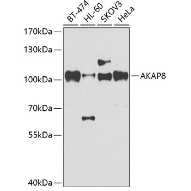 AKAP8 Rabbit Polyclonal Antibody