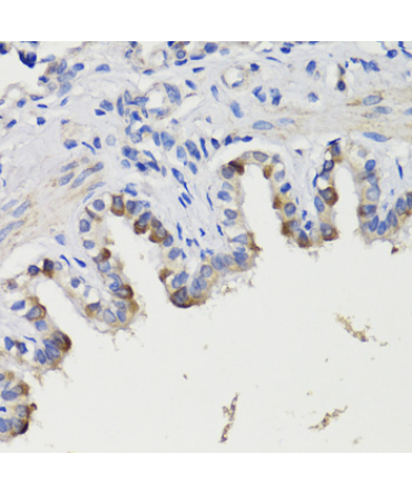DEPDC6 Rabbit Polyclonal Antibody