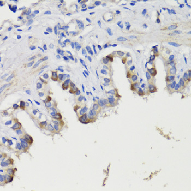 DEPDC6 Rabbit Polyclonal Antibody