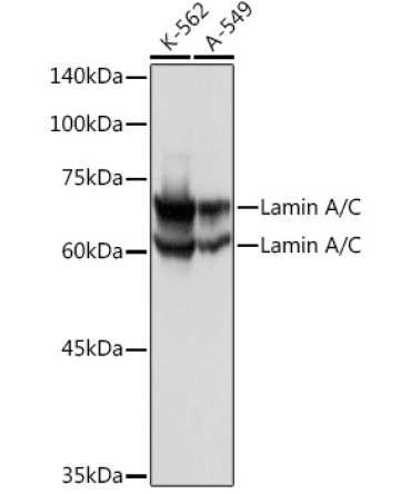 Lamin A/C Rabbit Polyclonal Antibody [KO Validated]