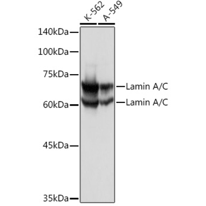 Lamin A/C Rabbit Polyclonal Antibody [KO Validated]