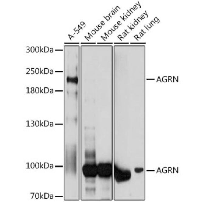 AGRN Rabbit Polyclonal Antibody
