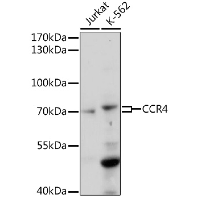 CCR4 Rabbit Polyclonal Antibody