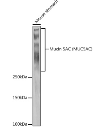 Mucin 5AC Rabbit Polyclonal Antibody