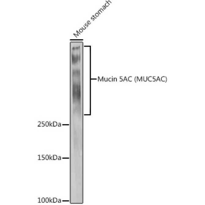 Mucin 5AC Rabbit Polyclonal Antibody