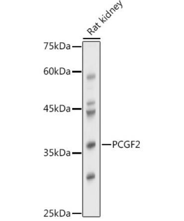 PCGF2 Rabbit Polyclonal Antibody